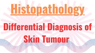 Differential Diagnosis of Skin Tumour [upl. by Fisk852]