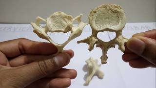 Vertebrae  Identification Features amp Differences [upl. by Aihsemak928]