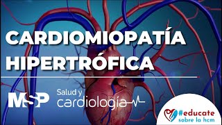 Cardiomiopatía Hipertrófica  ExclusivoMSP [upl. by Lesna]