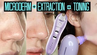 Pore Vacuum Blackhead Remover Microdermabrator Exfoliator Deep Cleaning Suction [upl. by Arahahs]