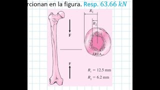 1315 Tippens ¿Cómo calcular el esfuerzo a través de un cilindro hueco [upl. by Ahseinek975]