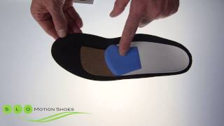 SLO Motion Condition Orthotics Sesamoiditis Hallux Rigidus Bunions [upl. by Augie]