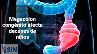 Megacolon congénito afecta decenas de niños [upl. by Aihsyn223]