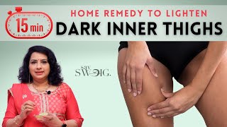 One quotSecret Ingredientquot To Lighten Dark Inner Thighs Fast  Natural Home Remedies  Vasundhara Tips [upl. by Elocal208]