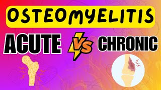 Osteomyelitis  Acute vs Chronic Osteomyelitis  Explained in 5 Minutes [upl. by Iaverne]