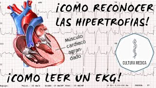 2 Fisiologia do Músculo Esquelético CONTRAÇÃO MUSCULAR ISOMÉTRICA E ISOTÔNICA  MK Fisiologia [upl. by Mott788]