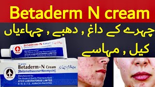 betaderm cream  betaderm n cream  betaderm n cream uses in urdu  betaderm n cream betaderm cream [upl. by Lokcin]