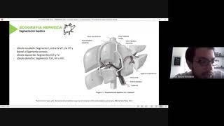 Ecografia hepatica y de vías biliares [upl. by Pearla]