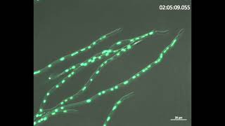 Nuclear distribution in filamentous fungi [upl. by Ennybor]