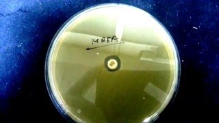 MRSA detection [upl. by Carrington]