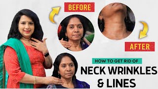 How to Tighten Your Saggy Neck Skin  Anti Ageing  Wax Therapy  Vasundhara Tips [upl. by Annhoj420]