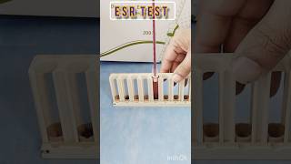 Esr westergren method  ESR test means  What does ESR lab test showlaboratory test bloodtest [upl. by Imre]