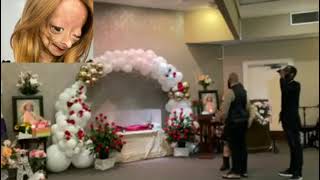 Adalia Rose last journey video Adalia Rose has passed away [upl. by Atekehs]