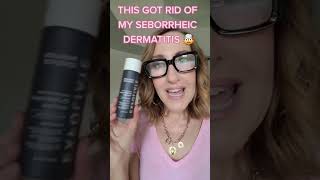 WATCH THIS IF YOU HAVE SEBORRHEIC DERMATITIS 🤯 [upl. by Lehmann208]