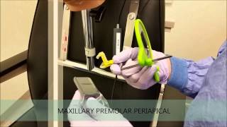 Maxillary Posterior Periapical Technique [upl. by Harak184]