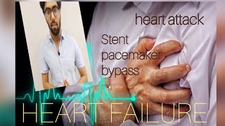 basics about stentsheart attackpacemakerbypass graftingheart failure [upl. by Litt]