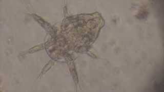 Nauplius Larva of Cyclops crustacean [upl. by Conan]