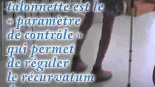 Equin du pied  recurvatum douloureux Traitement  talonnette 44582 [upl. by Rengaw941]