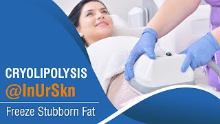 Cryolipolysis  Freeze Stubborn Fat InUrSkn [upl. by Milo]