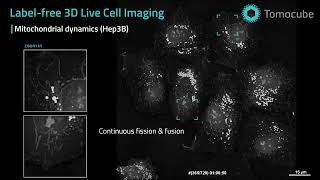 Mitochondrial dynamics  Labelfree 3D Live Cell Imaging [upl. by Seroka]