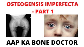 OSTEOGENESIS IMPERFECTA  PART 1  EPISODE 39 [upl. by Gorga]