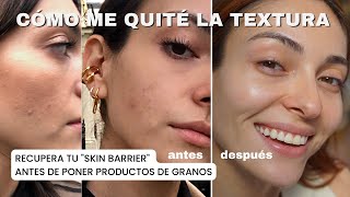 ¿Cómo quitar la textura de la piel DETOX  RUTINA de skincare para eliminar textura  Anna Sarelly [upl. by Anyrak513]