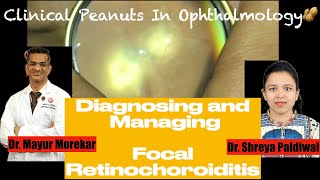 Toxoplasma RetinochoroiditisCase discussion for Ophthalmologists Residents trainees and students [upl. by Dulcy71]