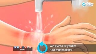 Yanıklarda ilk yardım nasıl yapılır yanıklardaneyapılır yanıklardailkyardım yanığaneiyigelir [upl. by Nolyk]