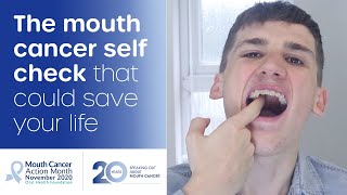 How to do a mouth cancer check at home [upl. by Alrick]