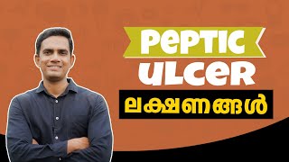 Peptic ulcer  അൾസർ  ഒരിക്കലും അവഗണിക്കാൻ പാടില്ലാത്ത ചില ലക്ഷണങ്ങൾ II Ulcer Malayalam health tips [upl. by Vladamar867]