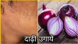 प्याज से दाढ़ी कैसे उगाये  how to grow a beard for onion 🧅 [upl. by Cramer]