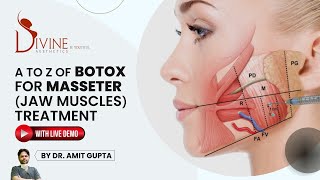 Botox for Masseter Jaw Muscles Treatment  Botox Treatment for Face  Botox Meaning [upl. by Arzed]