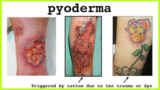 pyoderma [upl. by Cud]