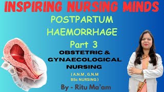 POSTPARTUM HAEMORRHAGE MANAGEMENT  ATONIC UTERUS  OBSTETRIC amp GYNAECOLOGICAL NURSING  RITU MA’AM [upl. by Assirhc]