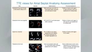 Guidelines for the Echocardiographic Assessment of Atrial Septal Defect amp Patent Foramen Ovale [upl. by Armin]