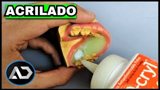 💧Como ACRILAR un Retenedor Continuo VERDE [upl. by Adur]