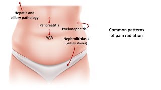 An Approach to Acute Abdominal Pain [upl. by Oona]