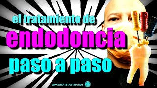 Como se hace la ENDODONCIA correctamente tratamiento de conductos [upl. by Gothurd]