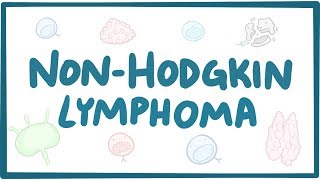 Nonhodgkin lymphoma  causes symptoms diagnosis treatment pathology [upl. by Nahn928]