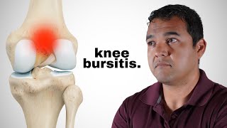 Knee Bursitis Causes Symptoms and Treatment Options [upl. by Yc679]