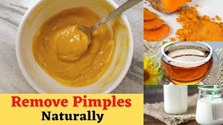 How to Remove Pimples and Dark Spots Naturally 100 Results  Miss fit fighter [upl. by Iduj]