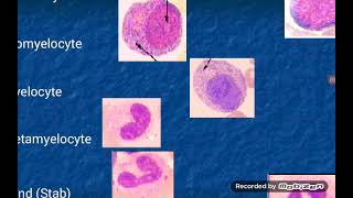 Leukopoiesis formation of White Blood Cells [upl. by Yesor336]