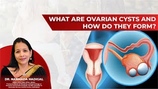 What are ovarian cysts and how do they form Dr Narmada Hadigal [upl. by Freud800]