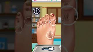 Nail treatment asmrNail care video Ingrown Toienail asme asmr animation shorts [upl. by Letsyrhc]