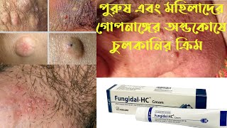 Fungidal HC cream uses  ফানজিডাল এইচ সি ক্রিমের ব্যবহার এবং কাজ  অন্ডকোষে চুলকানির ক্রিম [upl. by Ettenej130]