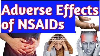 Antiinflammatory NSAIDs Drugs Adverse Effects Side Effects of NSAIDs Pharmacology pharmacist [upl. by Harimas]