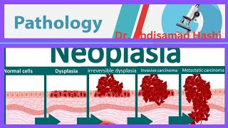 31 Neoplasia Cancer [upl. by Nnybor]