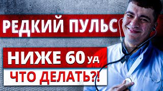 РЕДКИЙ ПУЛЬС БРАДИКАРДИЯ  ПУЛЬС НИЖЕ 60 УДАРОВ В МИНУТУ БЛОКАДЫ СЕРДЦА НОЧЬЮ ЧТО ДЕЛАТЬ [upl. by Oiracam]