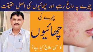 Face Skin Rashes Treatment UrduHindi  Dr Photo Sarwar Health Tips [upl. by Velasco]