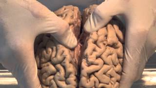 Introduction Neuroanatomy Video Lab  Brain Dissections [upl. by Derf]